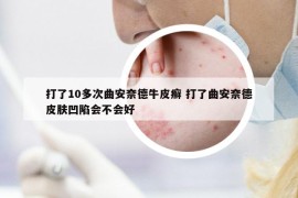 打了10多次曲安奈德牛皮癣 打了曲安奈德皮肤凹陷会不会好