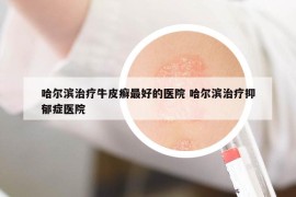 哈尔滨治疗牛皮癣最好的医院 哈尔滨治疗抑郁症医院