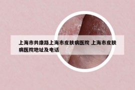 上海市共康路上海市皮肤病医院 上海市皮肤病医院地址及电话