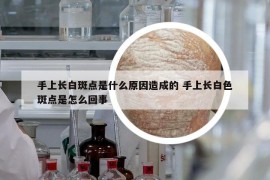 手上长白斑点是什么原因造成的 手上长白色斑点是怎么回事