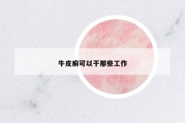 牛皮癣可以干那些工作