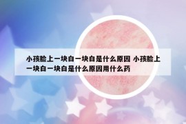 小孩脸上一块白一块白是什么原因 小孩脸上一块白一块白是什么原因用什么药