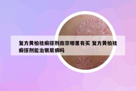 复方黄柏祛癣搽剂南京哪里有买 复方黄柏祛癣搽剂能治银屑病吗