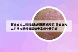 西安交大二附院皮肤科银屑病专家 西安交大二附院皮肤科银屑病专家哪个看的好