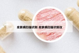 皮肤病扫描识别 皮肤病扫描识别仪