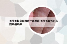 关节处长白斑因为什么原因 关节长白色的东西不痛不痒