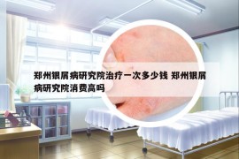 郑州银屑病研究院治疗一次多少钱 郑州银屑病研究院消费高吗
