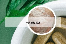牛皮癣经验方