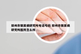 郑州市银屑病研究所电话号码 郑州市银屑病研究所医院怎么样