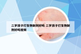 二岁孩子打生物制剂好吗 二岁孩子打生物制剂好吗视频