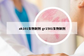 ak101生物制剂 gr1501生物制剂