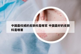 中国最权威的皮肤科是哪家 中国最好的皮肤科是哪里
