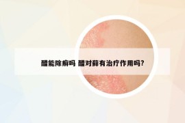 醋能除癣吗 醋对藓有治疗作用吗?