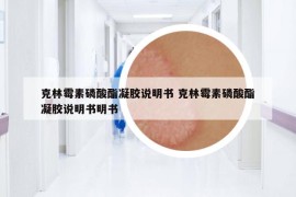 克林霉素磷酸酯凝胶说明书 克林霉素磷酸酯凝胶说明书明书
