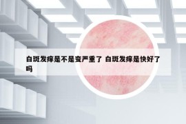 白斑发痒是不是变严重了 白斑发痒是快好了吗
