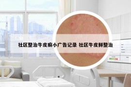 社区整治牛皮癣小广告记录 社区牛皮鲜整治