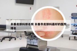 长春皮肤科排名榜 长春市皮肤科最好的医院排名
