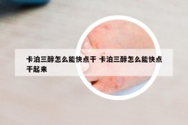 卡泊三醇怎么能快点干 卡泊三醇怎么能快点干起来