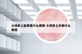 小孩身上起癣是什么原因 小孩身上长癣什么原因