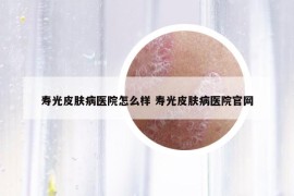 寿光皮肤病医院怎么样 寿光皮肤病医院官网