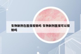 生物制剂在医保报销吗 生物制剂医保可以报销吗