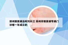 郑州银屑病当听刘长江 郑州市银屑病专病门诊哪一年成立的
