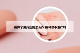 癣除了用药还能怎么办 癣可以不治疗吗