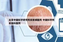 北京中国科学研究院皮肤病医院 中国科学院皮肤科医院