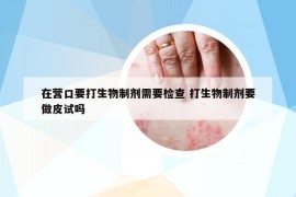 在营口要打生物制剂需要检查 打生物制剂要做皮试吗
