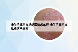 哈尔滨盛京皮肤病医院怎么样 哈尔滨盛京皮肤病医院官网