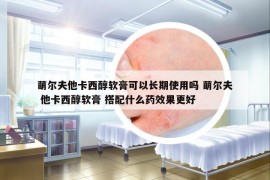萌尔夫他卡西醇软膏可以长期使用吗 萌尔夫 他卡西醇软膏 搭配什么药效果更好