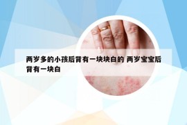 两岁多的小孩后背有一块块白的 两岁宝宝后背有一块白