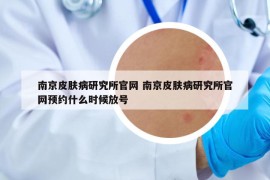 南京皮肤病研究所官网 南京皮肤病研究所官网预约什么时候放号