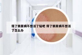 得了银屑病不想活了贴吧 得了银屑病不想活了怎么办