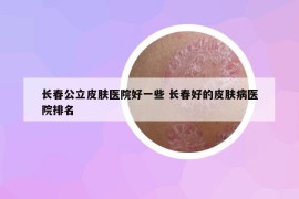 长春公立皮肤医院好一些 长春好的皮肤病医院排名