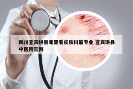 四川宜宾珙县哪里看皮肤科最专业 宜宾珙县中医院官网
