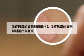 治疗风湿的生物制剂是什么 治疗风湿的生物制剂是什么名字