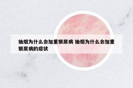 抽烟为什么会加重银屑病 抽烟为什么会加重银屑病的症状