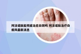 阿法诺肽能彻底治愈白斑吗 阿法诺肽治疗白瘕风最新消息