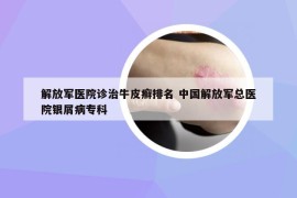 解放军医院诊治牛皮癣排名 中国解放军总医院银屑病专科