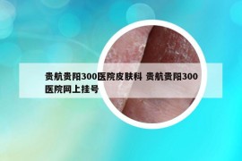 贵航贵阳300医院皮肤科 贵航贵阳300医院网上挂号