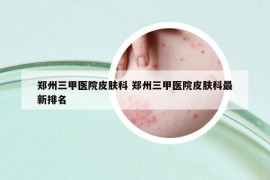 郑州三甲医院皮肤科 郑州三甲医院皮肤科最新排名