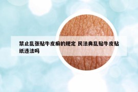 禁止乱张贴牛皮癣的规定 民法典乱贴牛皮贴纸违法吗