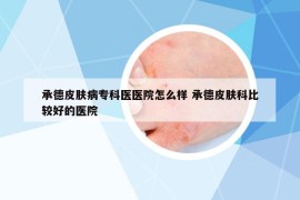 承德皮肤病专科医医院怎么样 承德皮肤科比较好的医院