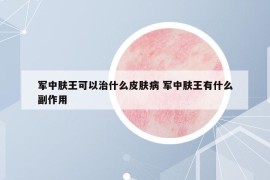 军中肤王可以治什么皮肤病 军中肤王有什么副作用