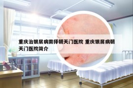重庆治银屑病需择朝天门医院 重庆银屑病朝天门医院简介