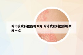 哈市皮肤科医院哪家好 哈市皮肤科医院哪家好一点