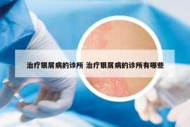 治疗银屑病的诊所 治疗银屑病的诊所有哪些