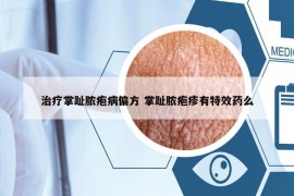 治疗掌趾脓疱病偏方 掌趾脓疱疹有特效药么