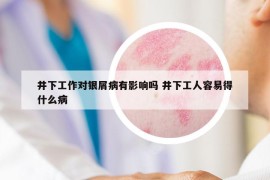 井下工作对银屑病有影响吗 井下工人容易得什么病